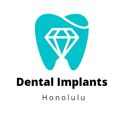 Dental Implants Honolulu